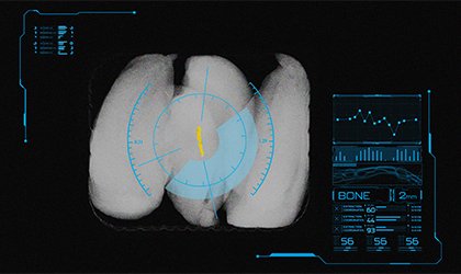 Safeline X-ray Dual Energy Technology