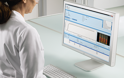 LabX PC Software for Slip Melting Point