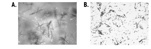 Altered Sample Shape/Size Due to Changed Particle Environment